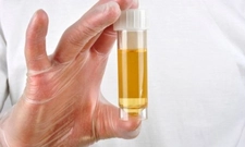 İdrarda Lökosit Yüksekliği Nedenleri?