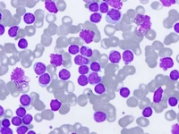 Lökosit Sayısı Kaçtır?