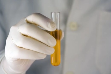 Hamilelikte Lökosit Nedir ve Kaç Olmalıdır?